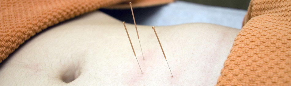 Accupuncture, Eastern Healing Arts in the New Hope, Bucks County PA area